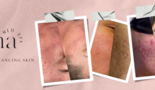 Luna Med Spa - permanent makeup in Kansas City, MO