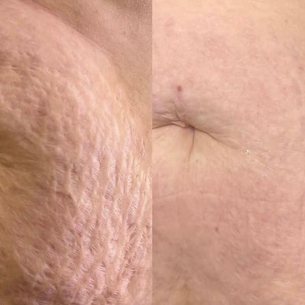 LUXE Ink + Aesthetics - permanent makeup in Salinas, CA