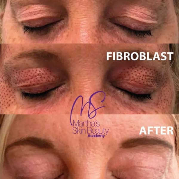 Marthaskinbeauty - permanent makeup in Boca Raton, FL