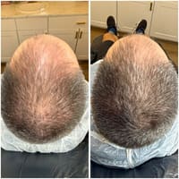 Microbae - permanent makeup work