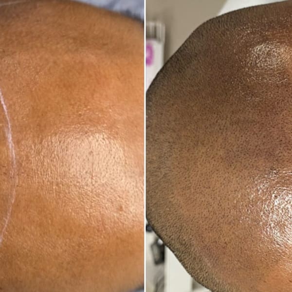 Microblading by AngelaC - Scalp Micropigmentation SMP - permanent makeup in Visalia, CA