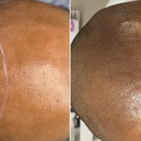 Microblading by AngelaC - Scalp Micropigmentation SMP - permanent makeup work