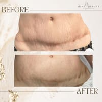 Mint Beauty Aesthetics LLC - permanent makeup work