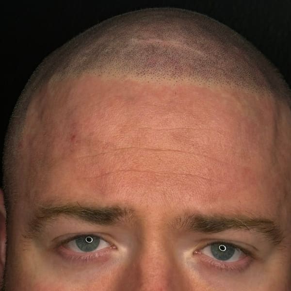 Natural Effect (Scalp Micropigmentation OKC) - permanent makeup in Oklahoma City, OK