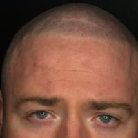 Natural Effect (Scalp Micropigmentation OKC) - permanent makeup work