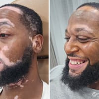 Natural Effects Medical Tattooing - permanent makeup work