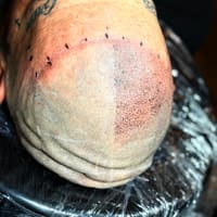 New Mexico SMP Scalp Micropigmentation Clinic - permanent makeup work