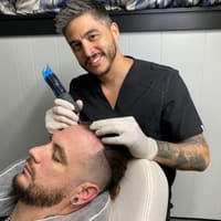 New Style Scalp Micropigmentation Illinois - permanent makeup work