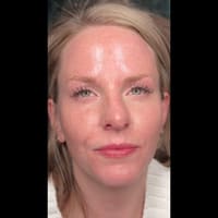 NoCO Aesthetics Studio - permanent makeup work