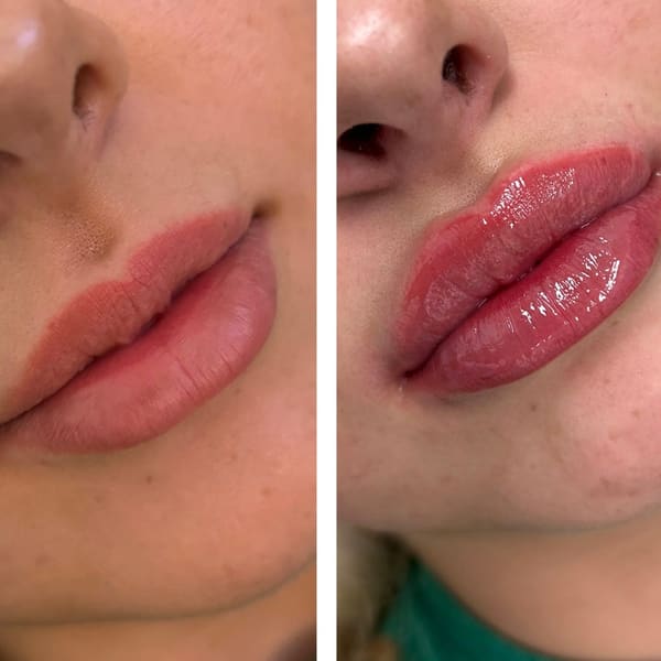 Noydeen Med Spa of Conway Arkansas - permanent makeup in Conway, AR