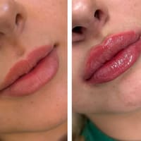 Noydeen Med Spa of Conway Arkansas - permanent makeup work