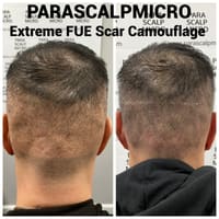 Parascalpmicro Institute-Scalp & Scar Clinic - permanent makeup work