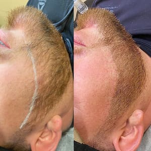 Permanent makeup work by 3D Camouflage AZ in Phoenix, AZ
