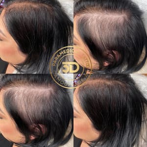 Permanent makeup work by 3D Camouflage AZ in Phoenix, AZ