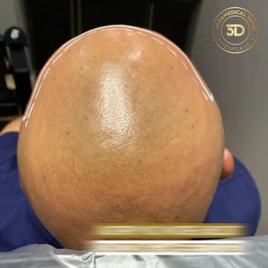 Permanent makeup work by 3D Camouflage AZ in Phoenix, AZ