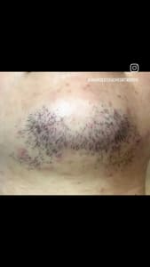 Permanent makeup work by A Nurses Touch Skin Care & Med Spa in Fort Worth, TX