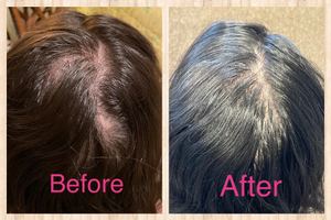 Permanent makeup work by AdvancedMD Aesthetics of Atlanta: Maki Rheaume, MD in Marietta, GA