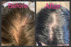 Permanent makeup work by AdvancedMD Aesthetics of Atlanta: Maki Rheaume, MD in Marietta, GA