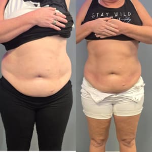 Permanent makeup work by Amethyst Aesthetics Beauty Clinic - Prime Health of Florida PA in Lakeland, FL