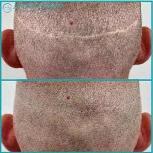 Permanent makeup work by Anna Burns Permanent Cosmetics in Atlanta, GA
