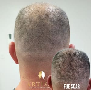 Permanent makeup work by Artisan Scalp Micropigmentation in Middlesex, NJ