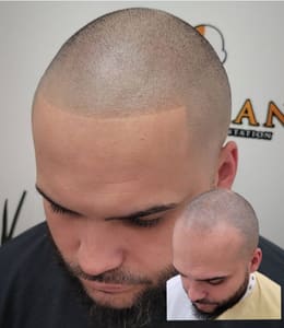 Permanent makeup work by Artisan Scalp Micropigmentation in Middlesex, NJ