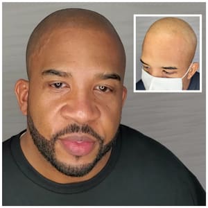 Permanent makeup work by ATL Scalp Micro in Atlanta, GA