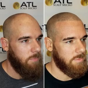 Permanent makeup work by ATL Scalp Micro in Atlanta, GA
