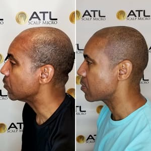 Permanent makeup work by ATL Scalp Micro in Atlanta, GA