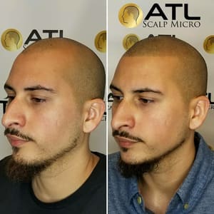 Permanent makeup work by ATL Scalp Micro in Atlanta, GA