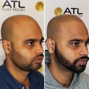 Permanent makeup work by ATL Scalp Micro in Atlanta, GA