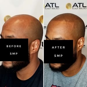 Permanent makeup work by ATL Scalp Micro in Atlanta, GA