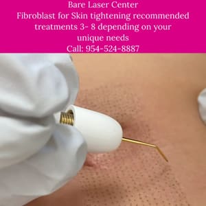 Permanent makeup work by Bare Laser Center in Fort Lauderdale, FL