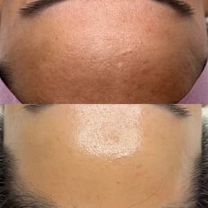 Permanent makeup work by Beauty By Tifini in Huntington Beach, CA