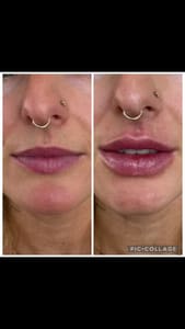 Permanent makeup work by Bellissima Medical Spa in Long Beach, CA