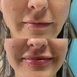 Permanent makeup work by Brandy Marie Family & Aesthetic Care in Clinton, UT