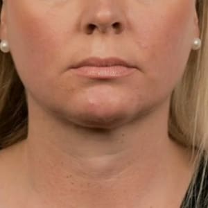Permanent makeup work by Candy Luther, Medical Aesthetician in Greenville, SC