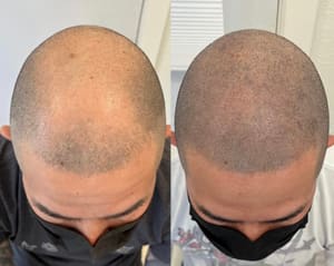 Permanent makeup work by COSMETAT I Stretch Mark Camouflage & Cosmetic Tattoo in Vancouver, WA
