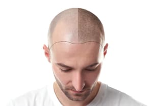 Permanent makeup work by Downey Hair Loss Solutions SMP in Ventura, CA