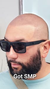 Permanent makeup work by Downey Hair Loss Solutions SMP in Ventura, CA