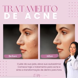 Permanent makeup work by Eleni Mozzer Advanced Aesthetics & PMU in Chelmsford, MA