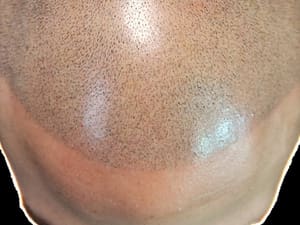 Permanent makeup work by Envision Microscalp in Dixon, CA