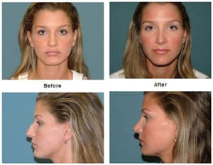 Permanent makeup work by Estetica Institute of the Palm Beaches in Palm Beach Gardens, FL
