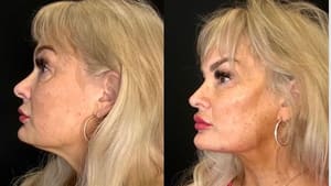 Permanent makeup work by Fine Fittings in Surprise, AZ