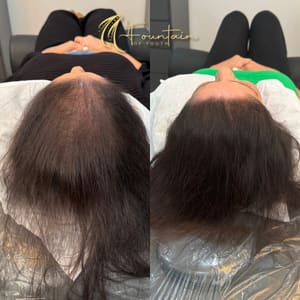 Permanent makeup work by Fountain of Youth Women's Scalp Micropigmentation in Berkeley, CA
