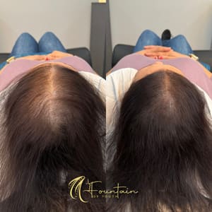 Permanent makeup work by Fountain of Youth Women's Scalp Micropigmentation in Berkeley, CA