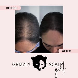 Permanent makeup work by Grizzly Scalp - Scalp Micropigmentation in National City, CA
