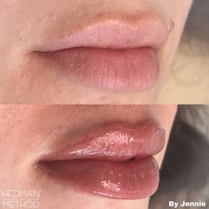 Permanent makeup work by Hedman Method in Miami, FL