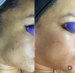Permanent makeup work by Hollywood Skin Atlanta Sugar Hill in Sugar Hill, GA