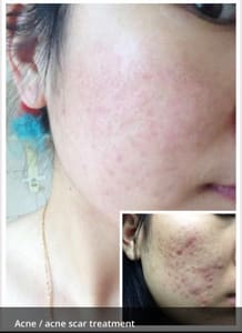 Permanent makeup work by I Beauty&Lash&Microblading in Chino Hills, CA